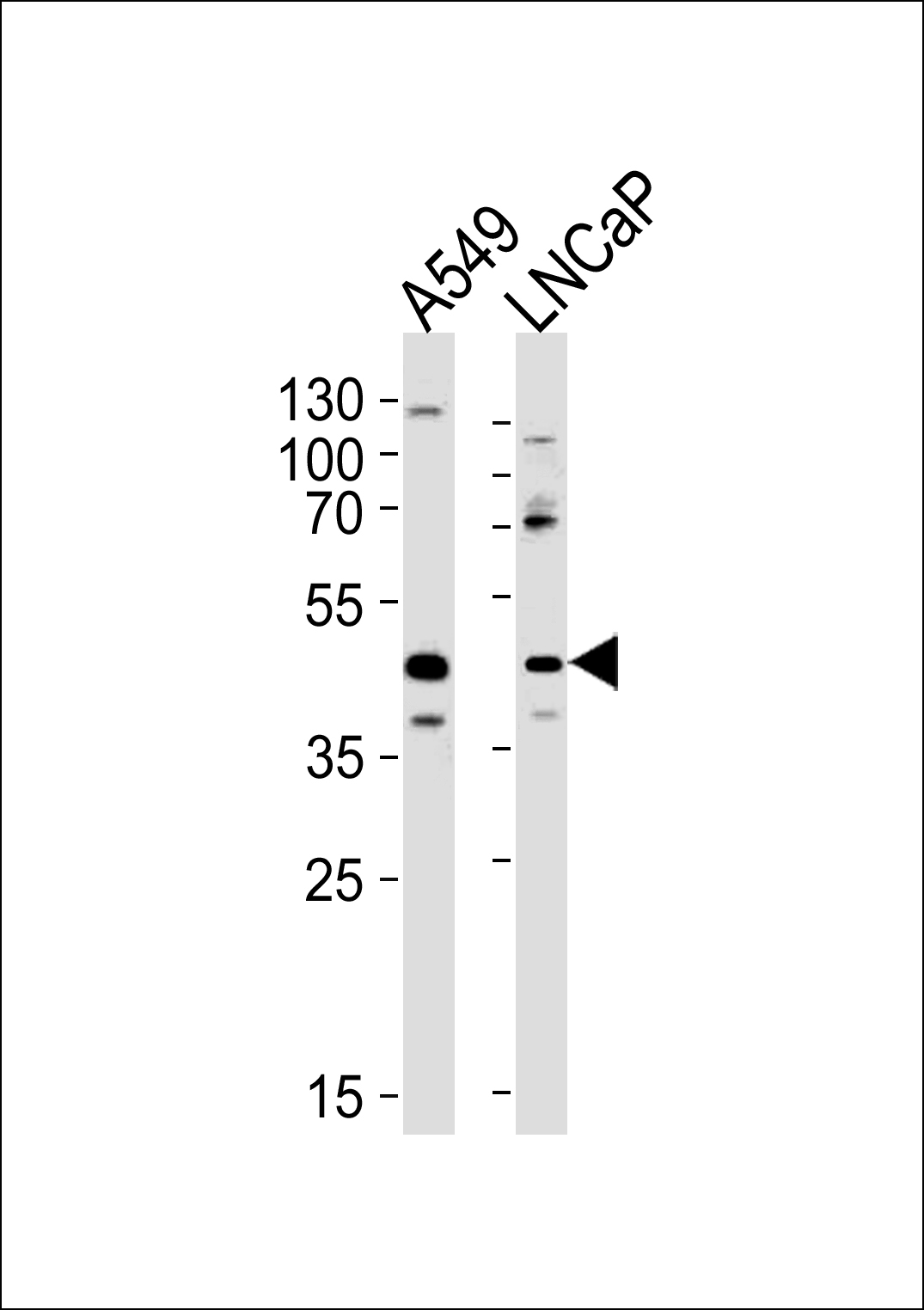 WB - GGN Antibody (Center) AP20537c